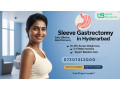 sleeve-gastrectomy-operation-in-hyderabad-top-weight-loss-clinic-small-0