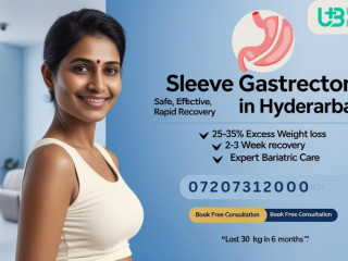 Sleeve Gastrectomy Operation in Hyderabad | Top Weight Loss Clinic