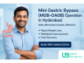 mini-gastric-bypass-mgb-oagb-operation-in-hyderabad-leading-weight-loss-clinic-small-0